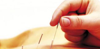 terapia akupunktura