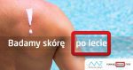 Badamy skórę po lecie Badamy skórę po lecie