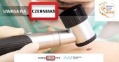 Uwaga na czerniaka Uwaga na czerniaka