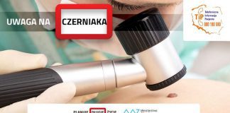 Uwaga na czerniaka