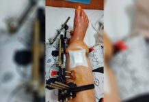 Uwaga pilnie potrzebna pomoc dla walczących na Ukrainie