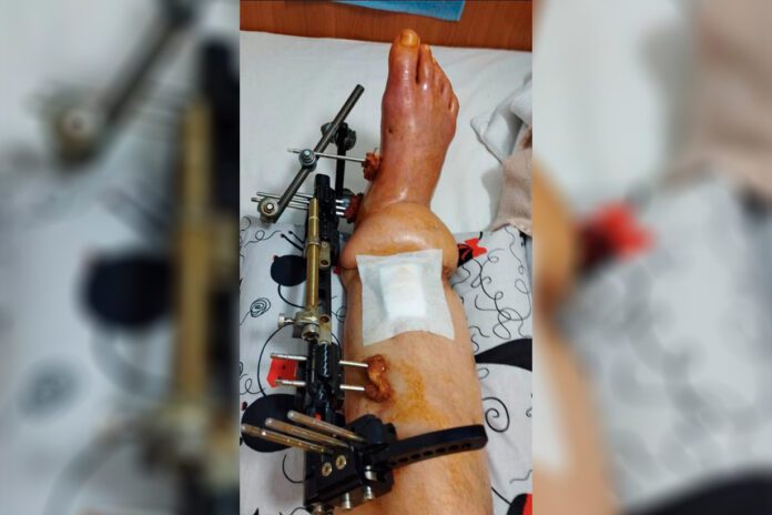 Uwaga pilnie potrzebna pomoc dla walczących na Ukrainie