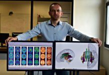 Naukowiec z Tarnowa szuka pierwszych oznak choroby Alzheimera