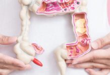 Rak jelita grubego - badanie